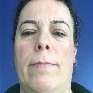 Meet your Posher, Bisera